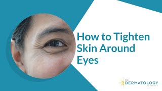 How to Tighten Skin Around Eyes  Reduce Wrinkles [upl. by Araz465]