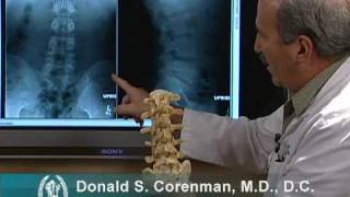 How to Read Xrays of the Lumbar Spine Lower Back  Spine Surgeon Colorado [upl. by Leoline]