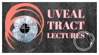 Ophthalmology 159 a Uveal Tract Anatomy Uvea Uveitis Classification eye What is classify parts [upl. by Ware]