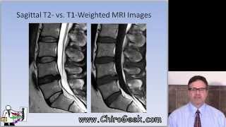 Dr Gillard lectures on How to Read Your Lumbar MRI [upl. by Jeanna]