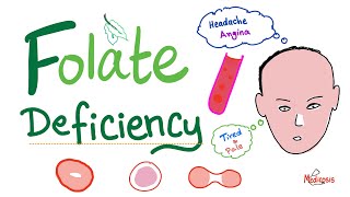 Folate deficiency  Megaloblastic Anemia  Macrocytic  Hematology Series [upl. by Adnawt]