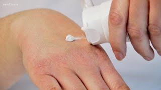 Understanding what causes eczema [upl. by Adnilec]