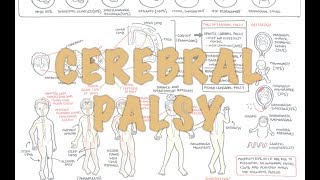 Cerebral Palsy  DETAILED Overview [upl. by Otsirave]