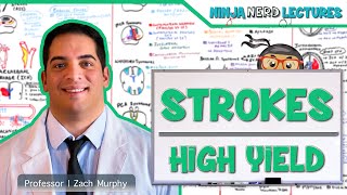 Ischemic and Hemorrhagic Strokes  High Yield [upl. by Atiloj]