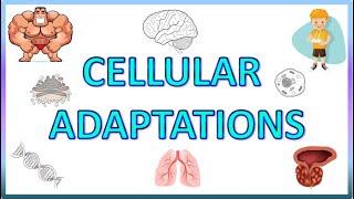 Differentiation of tumors Anaplasia  neoplasia  pathology [upl. by Iralam]