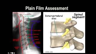 Cervical Spine XRay [upl. by Amoeji98]