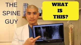 How to read a Lumbar Xray [upl. by Philis346]