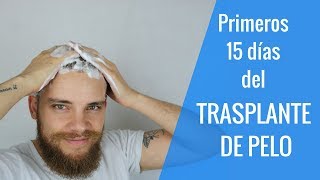 TRASPLANTE DE PELO  ¿QUÉ HACER LOS PRIMEROS DÍAS ¿QUÉ PUEDES SUFRIR [upl. by Alaik]