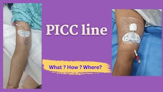 PICC Line Insertion  Patient Education video [upl. by Kotz]