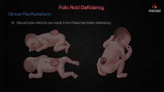 Folic Acid deficiency  USMLE Biochemistry [upl. by Adnohser]