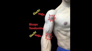 Biceps Tendonitis Treatment At Home Relieve Pain Fast [upl. by Aynnek845]