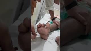 Upgoing plantar reflex positive Babinskis test [upl. by Safko]