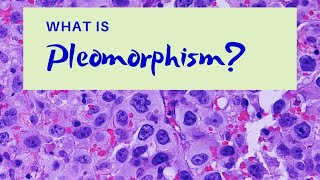 Metaplasia  Difference between Metaplasia and Dysplasia  Dysplasia [upl. by Conall]