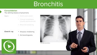 Bronchitis Treatment Options [upl. by Baptiste]