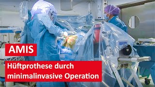 Hüftprothese durch minimalinvasive AMIS Methode  Live Operation [upl. by Cassil]