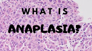 What is Dysplasia  Pathology mini tutorial [upl. by Mayce]