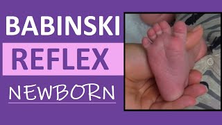 Babinski Reflex Assessment in Newborn Infant  Pediatric Nursing Clinical Skills [upl. by Ahasuerus]