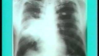 XRay reading radiology Part1 [upl. by Whitehurst]