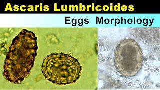 Ascaris lumbricoides eggs Morphology [upl. by Rie]