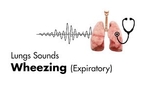 Wheezing expiratory  Lung Sounds  MEDZCOOL [upl. by Ener]