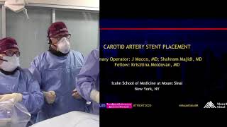 Transradial Carotid Artery Stenting [upl. by Templia]