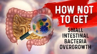 How to STOP Small Intestine Bacterial OvergrowthSIBO – Dr Berg [upl. by Devinne]