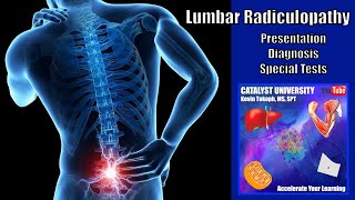 Lumbar Radiculopathies  Presentation Diagnosis amp Special Tests [upl. by Novaelc]