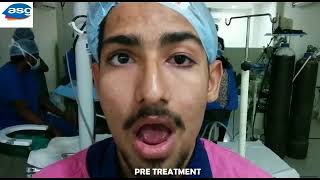 Dr Kotlus tells how to fix a droopy eyelid [upl. by Enrak]