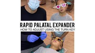 Rapid Palatal Expander or RPE [upl. by Ymij]