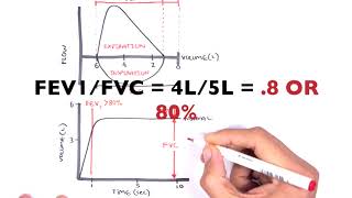 How is Spirometry performed [upl. by Keryt]