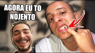 COLOQUEI UM DENTE DE OURO [upl. by Aldus]