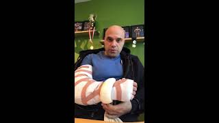 Week 1  Recovery Following Distal Bicep Tendon Tear Surgery [upl. by Adnolor730]