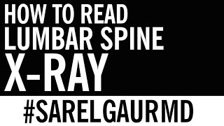 How to Read Lumbar Spine XRay  Anatomy [upl. by Lecram]