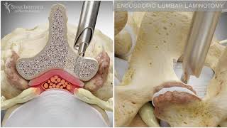 Barrett’s Esophagus Role of Advanced Endoscopy in the Diagnosis and Treatment [upl. by Vaughn]