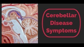 Cerebellar Disease Symptoms [upl. by Evanthe]