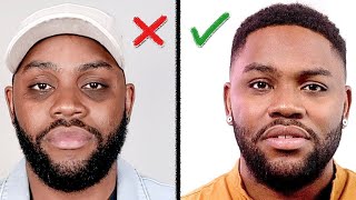 Remove DARK CIRCLES Under Your Eyes How I Did It Mens Skin Care [upl. by Nevin]