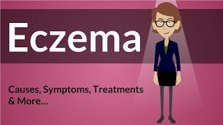 Eczema  Causes Symptoms Treatments amp More… [upl. by Gewirtz]