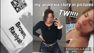 my anorexia story TW [upl. by Dolley172]