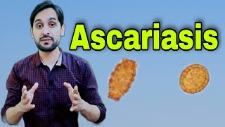 Ascariasis Infection  Ascaris Lumbricoides  Diagnosis  Life Cycle and Treatment [upl. by Anirbac]