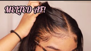 How to RE Install Frontal Wigs for Beginners  VERY DETAILED  Melt Transparent Lace [upl. by Anglim]