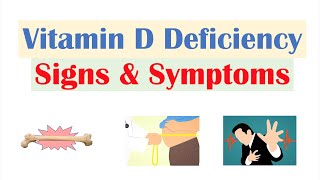 Vitamin D Deficiency Signs amp Symptoms ex Fatigue Diagnosis Treatment [upl. by Spielman]