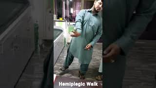 Hemiplegic Cerebral palsy  Hemiplegic gait [upl. by Seiuqram953]