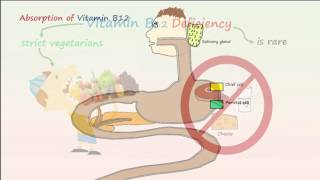 Megaloblastic Anemia Part 1 Vitamin B12 Deficiency Anemia [upl. by Carhart]