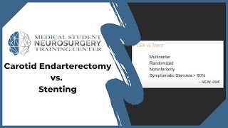 Carotid Endarterectomy vs Stenting [upl. by Ilajna249]