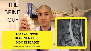 Lumbar Degenerative Disc Disease Part 1 Symptoms and Imaging [upl. by Kirt]