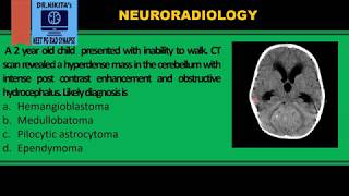 Medulloblastoma II CTMRI findings [upl. by Laina]