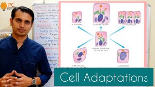 What is Metaplasia Types and Examples Pathology Help Pathology Lecture [upl. by Lambart400]