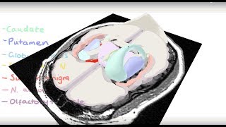 Basal Ganglia 3D Tour [upl. by Halliday]