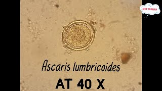 Ascaris lumbricoides Roundworm best view under microscope at 40XParasite in stool microscopy [upl. by Laurens438]