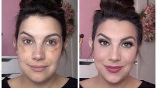 FULL COVERAGE Makeup for Melasma amp Discoloration [upl. by Enair]